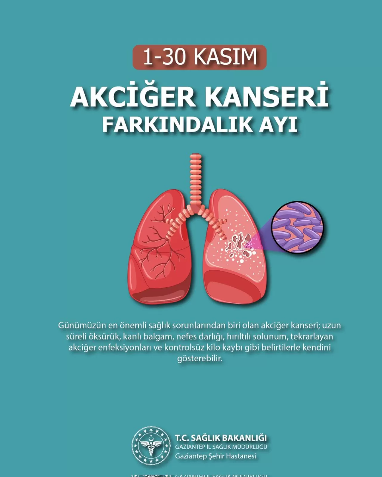 Gaziantep Şehir Hastanesi'nden Akciğer Kanseri Uyarısı: Erken Teşhis Hayat Kurtarır