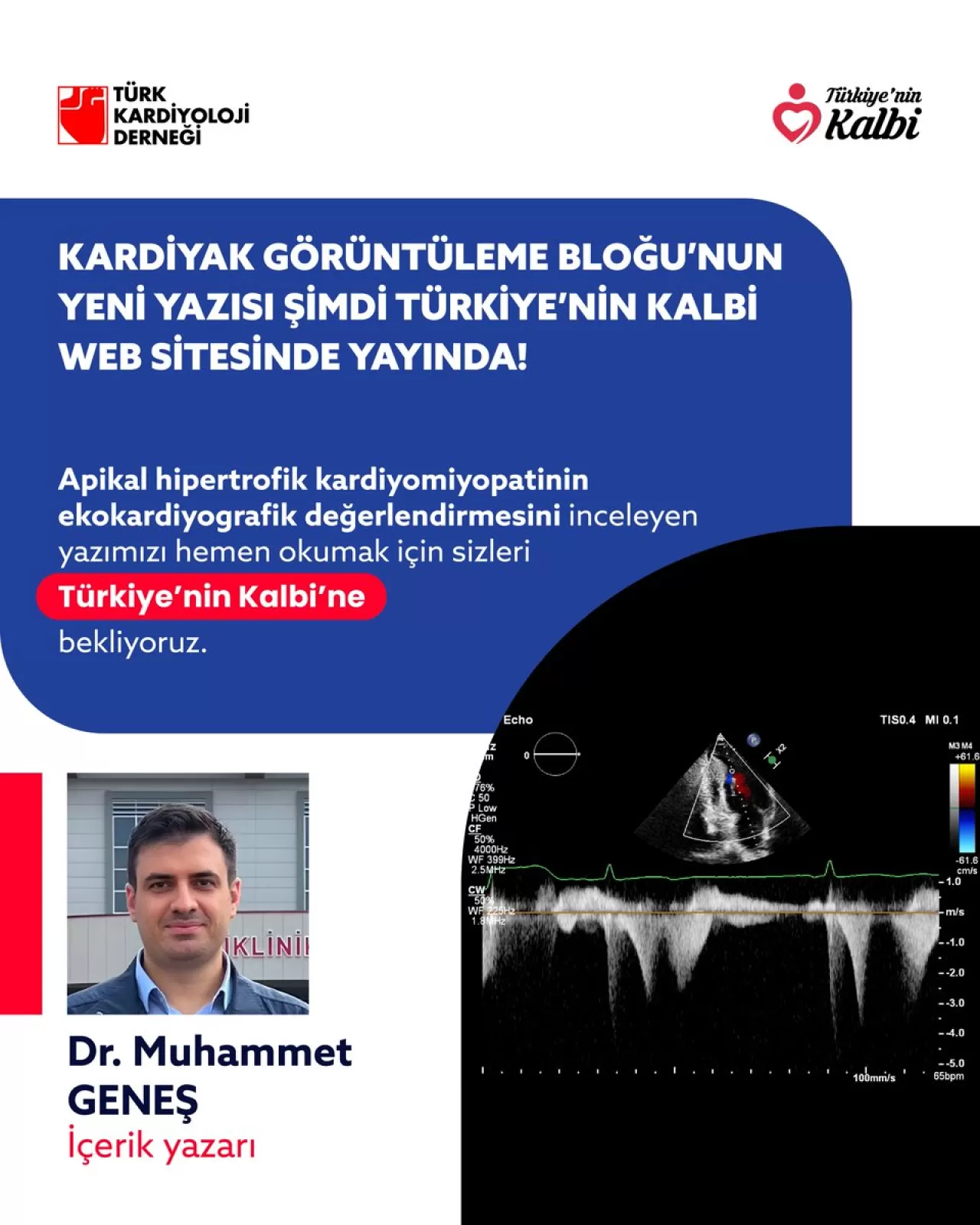 Apikal Hipertrofik Kardiyomiyopatinin Ekokardiyografik Değerlendirmesi