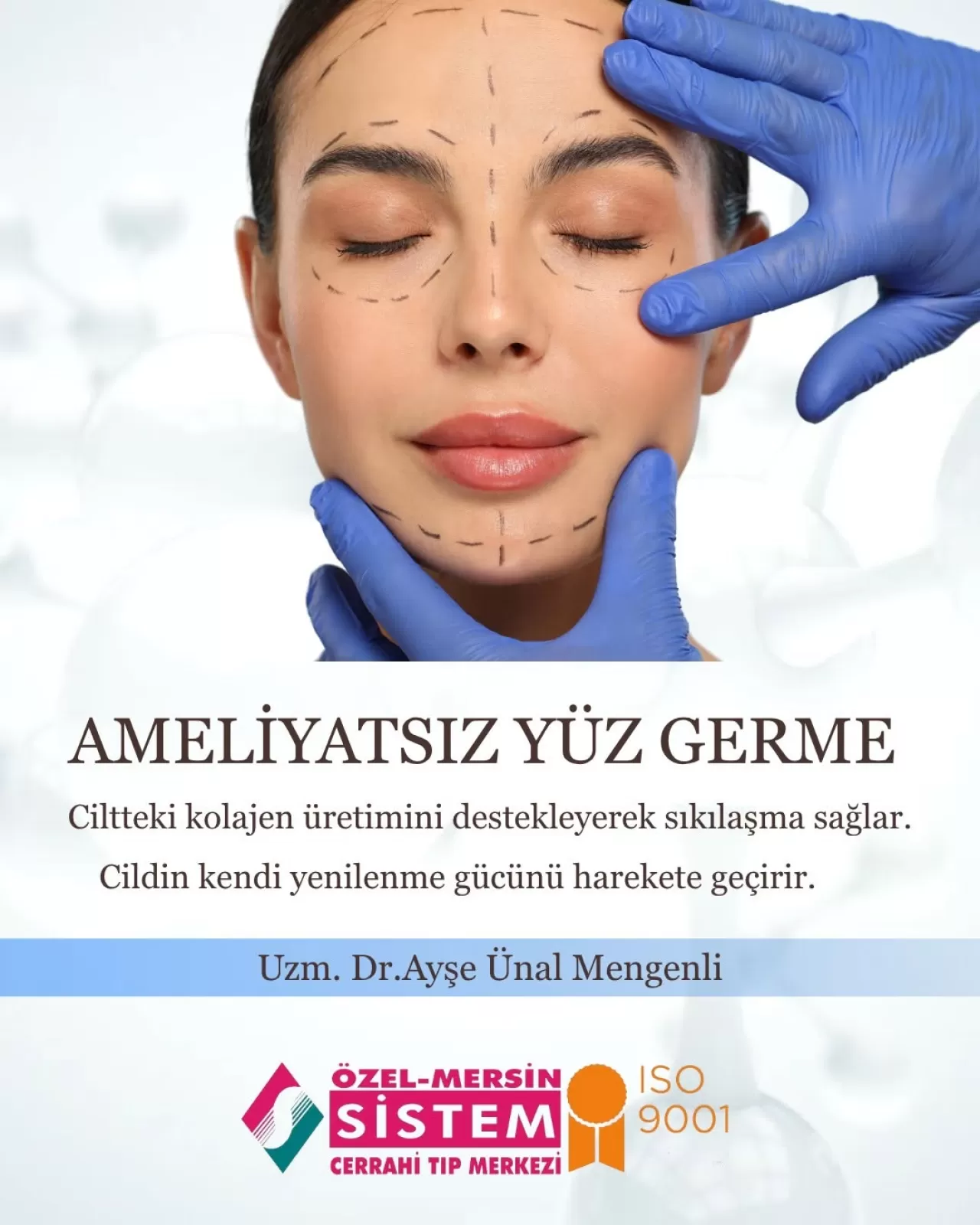 Mersin'de Ameliyatsız Yüz Germe ile Genç ve Dinamik Bir Görünüm