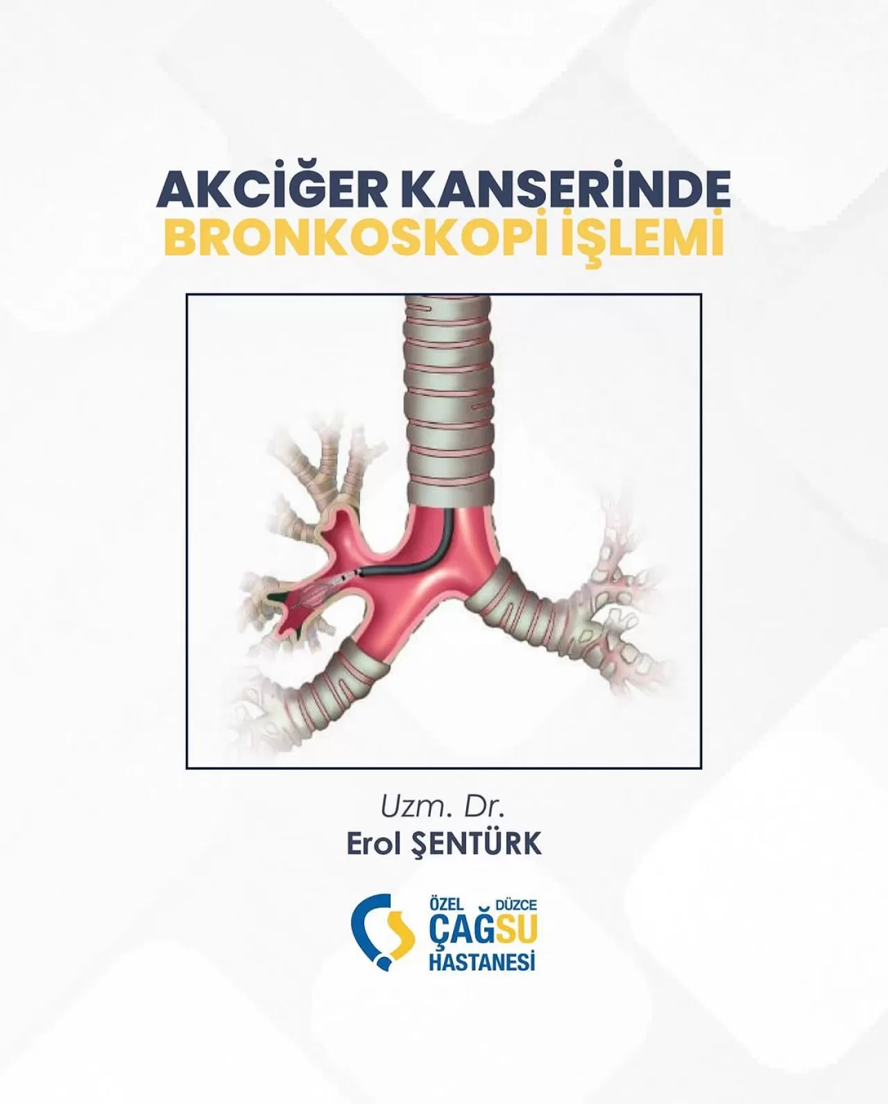 Düzce Çağsu Hastanesi'nde Bronkoskopi İşlemi Uygulanmaya Başlandı