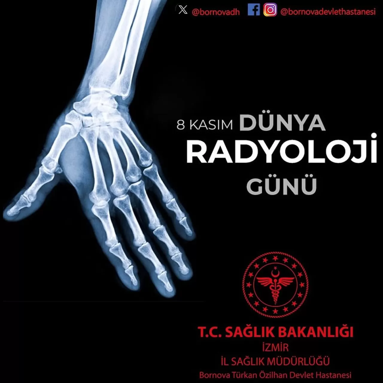 8 Kasım Dünya Radyoloji Günü: X Işınlarının Keşfinden Modern Tıbbi Görüntülemeye