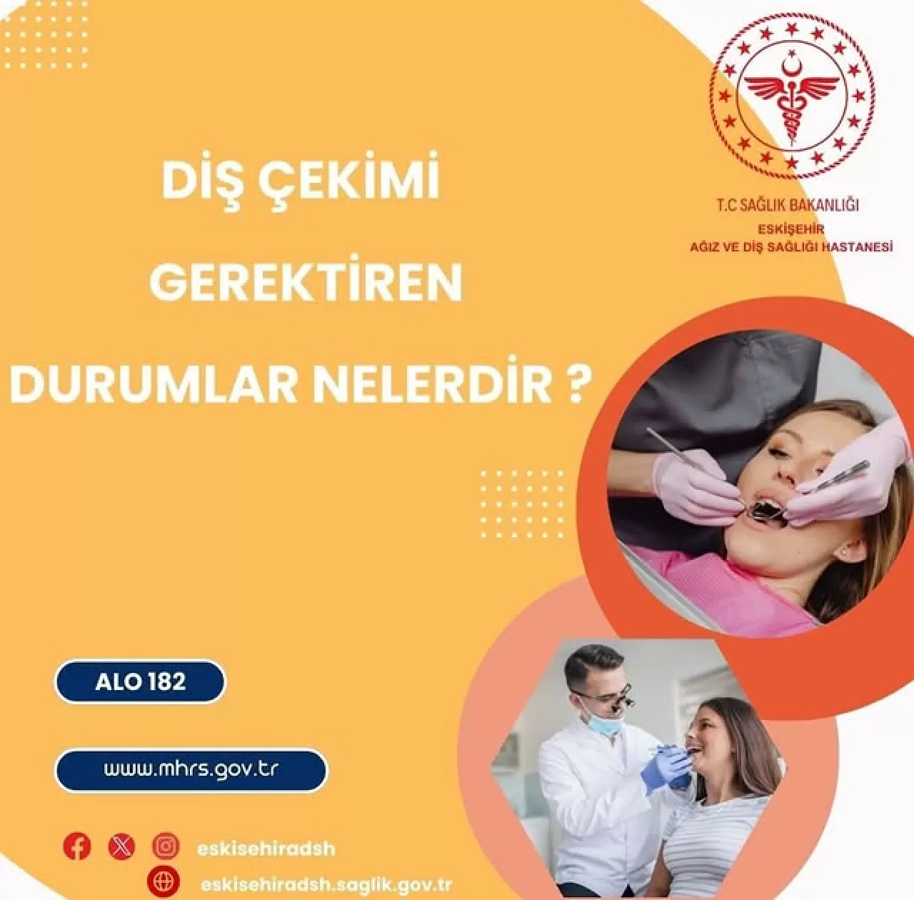 Eskişehir Ağız Diş Sağlığı Hastanesi'nden Gömülü Diş Çekimi ile İlgili Önemli Bilgiler