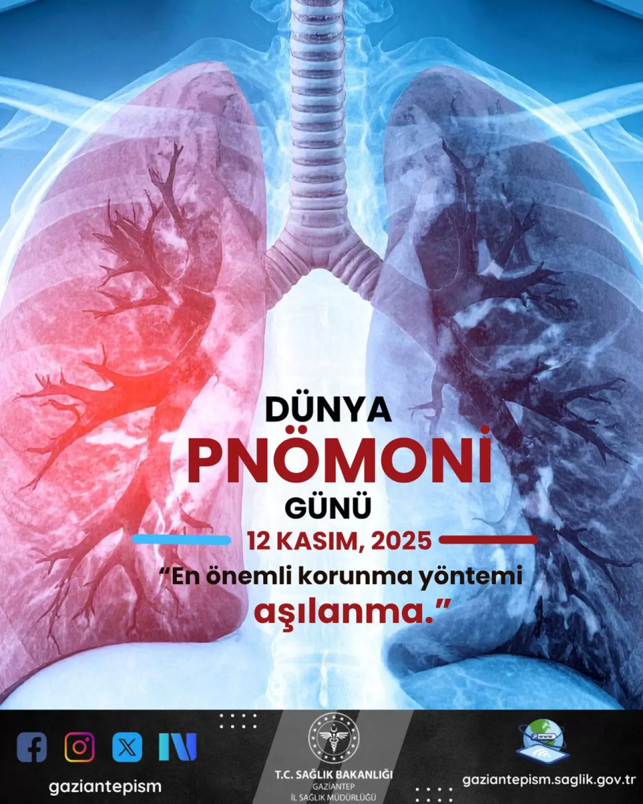 Dünya Pnömoni Günü'nde Zatürreye Karşı Korunma Yolları