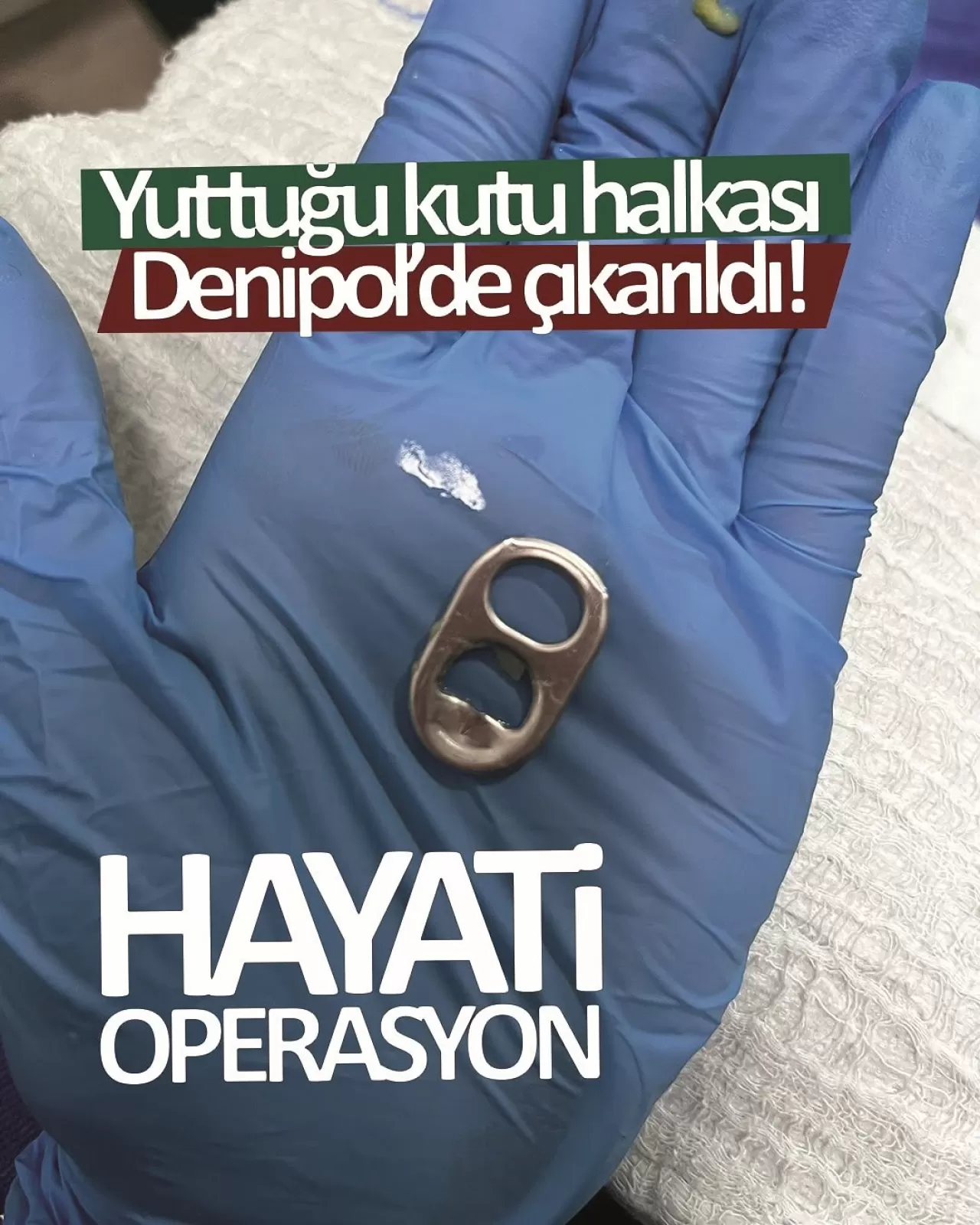 Kutu Kolayı İçerken Açma Halkasını Yutan Kız İçin Zamanla Yarışan Müdahale