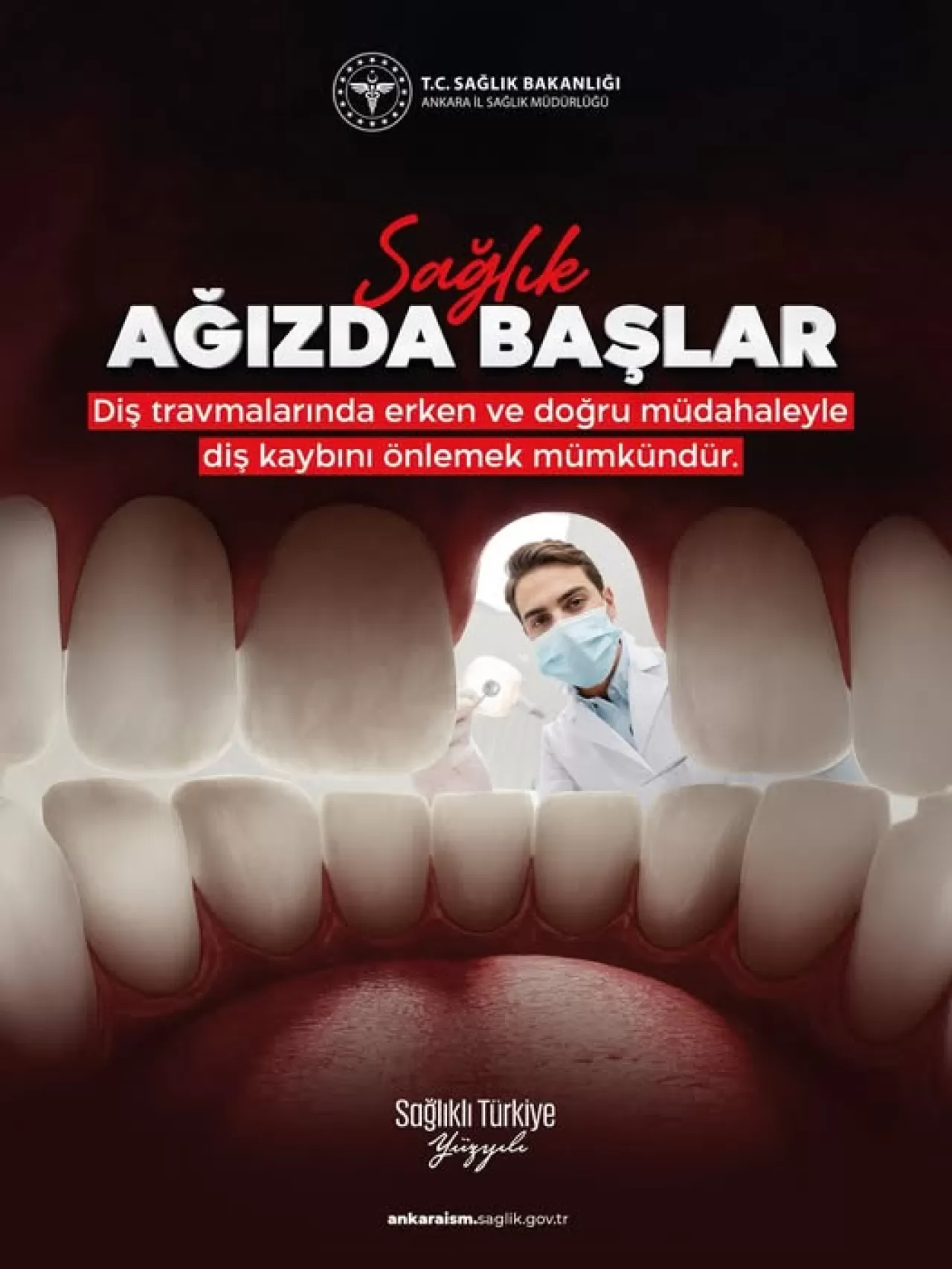 Ankara İl Sağlık Müdürlüğü, Diş Travmalarında Erken Müdahalenin Önemine Dikkat Çekti