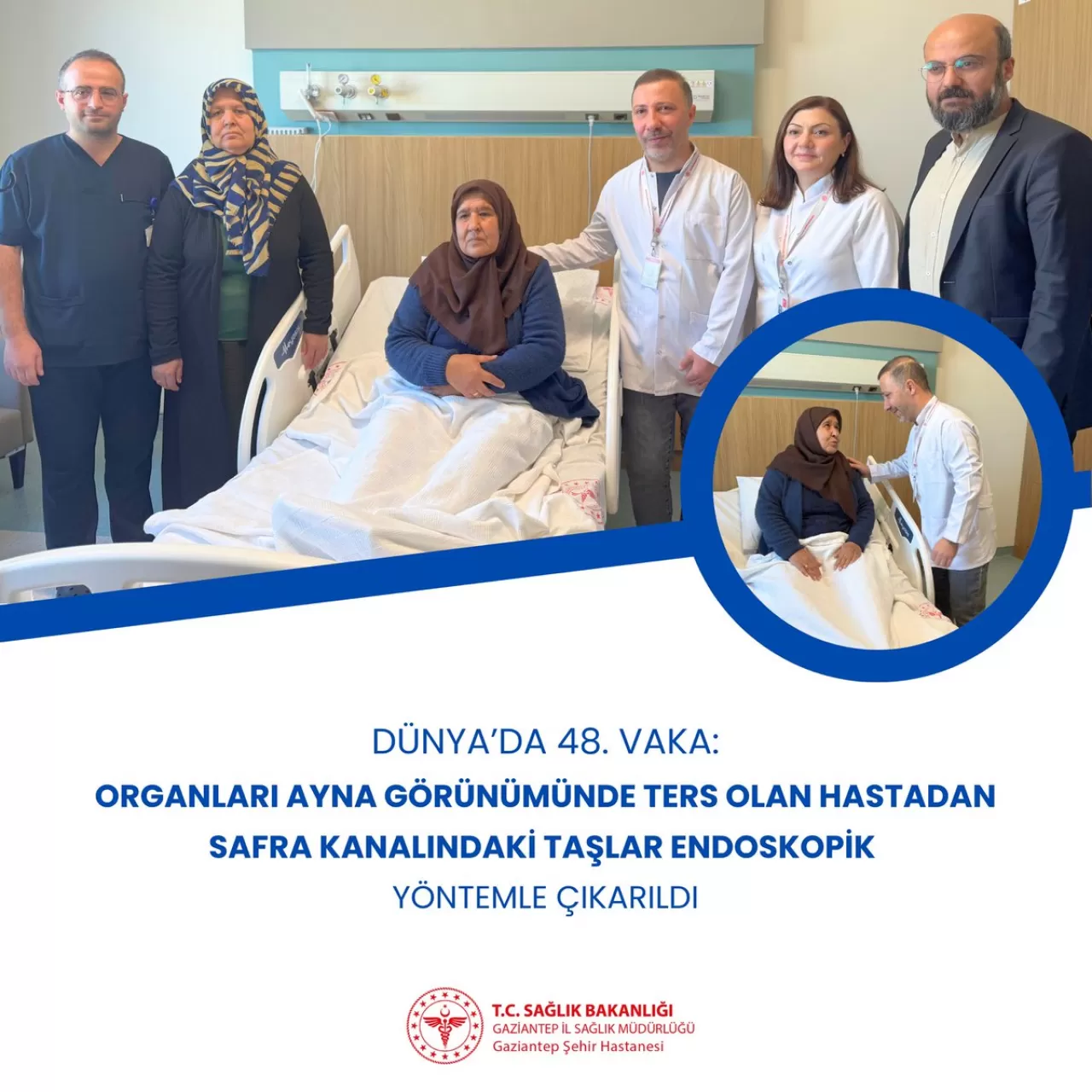 Dünyada 48 Vaka: Organları Ters Yerleşimli Hastada Başarılı Safra Yolu Müdahalesi