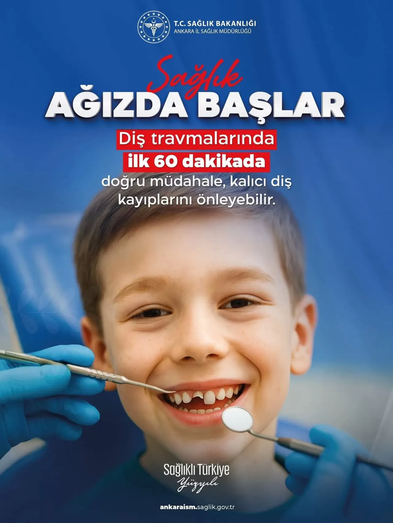 Diş Travmalarında İlk 60 Dakikaya Dikkat: Kalıcı Diş Kayıpları Önlenebilir