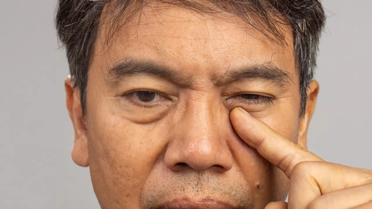 Dijital Ekranların Sessiz Tehlikesi: Görsel Stres ve Kronik Göz Kuruluğu