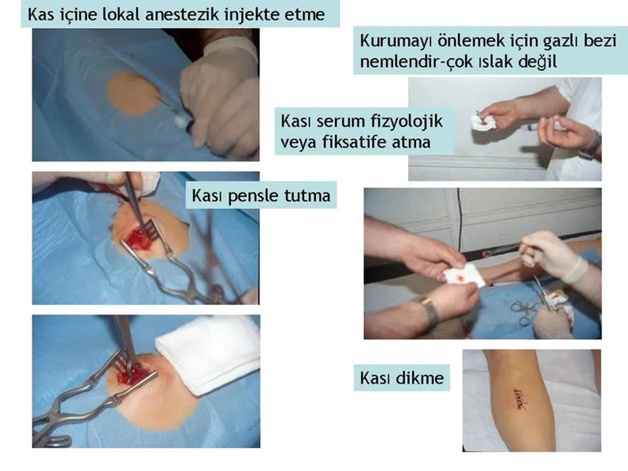 Günlük Yaşamda Sinsi Tehlike: Kronik Kas Atrofisi ve 
