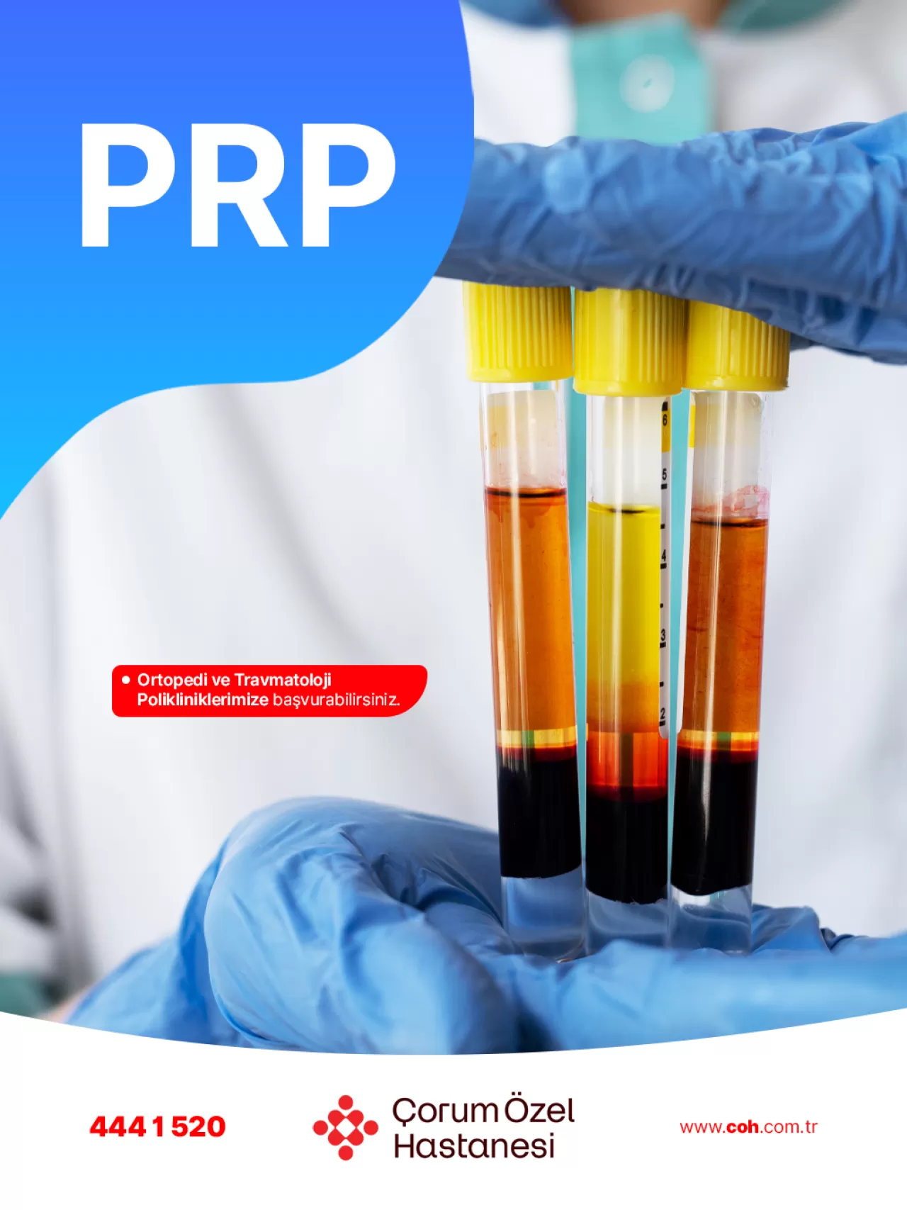 Çorum Özel Hastanesi'nde PRP Tedavisi ile Ortopedik Sorunlara Çözüm