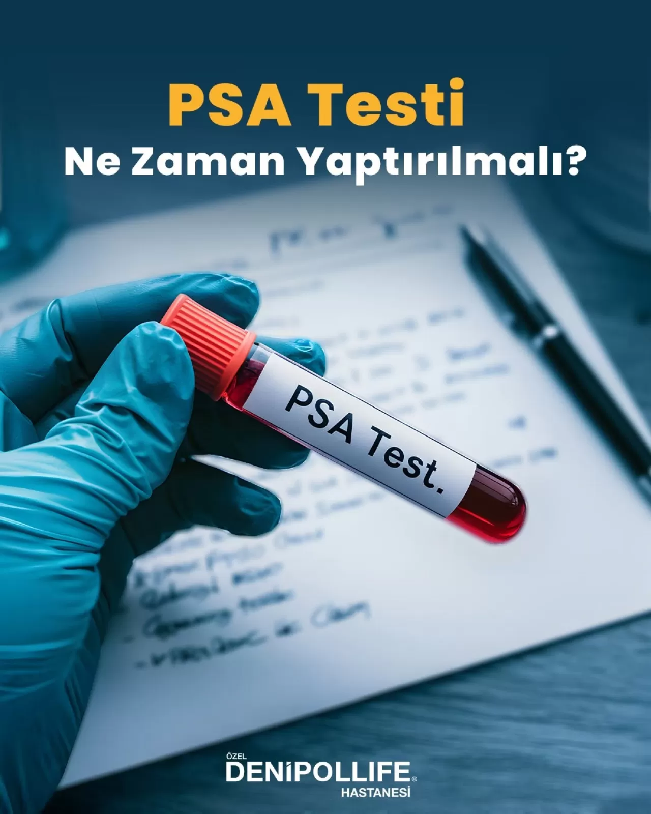 PSA Testi ile Prostat Sağlığınızı Erken Teşhis Edin