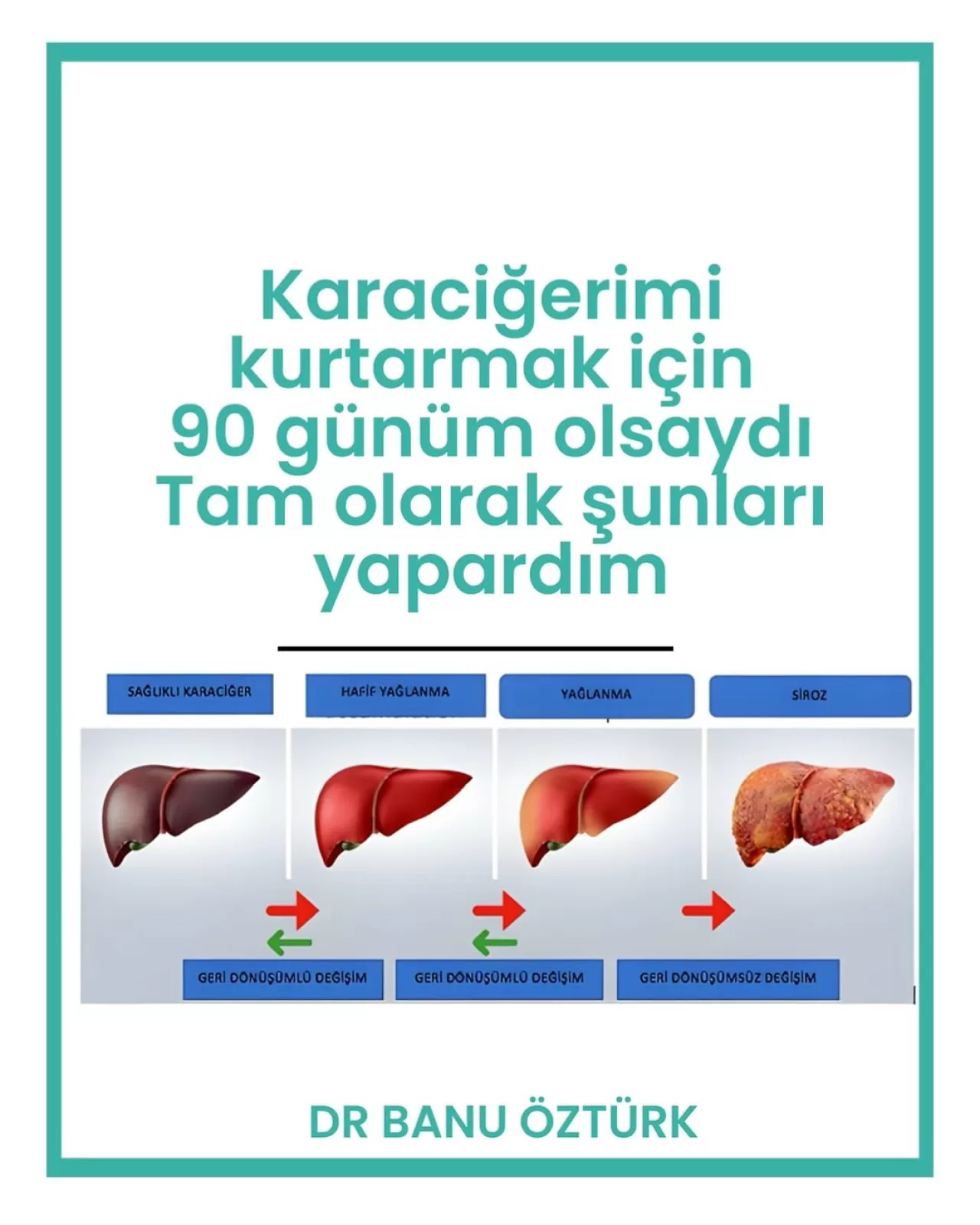 Karaciğer Yağlanmasını 90 Günde Geri Çevirmenin 6 Adımı