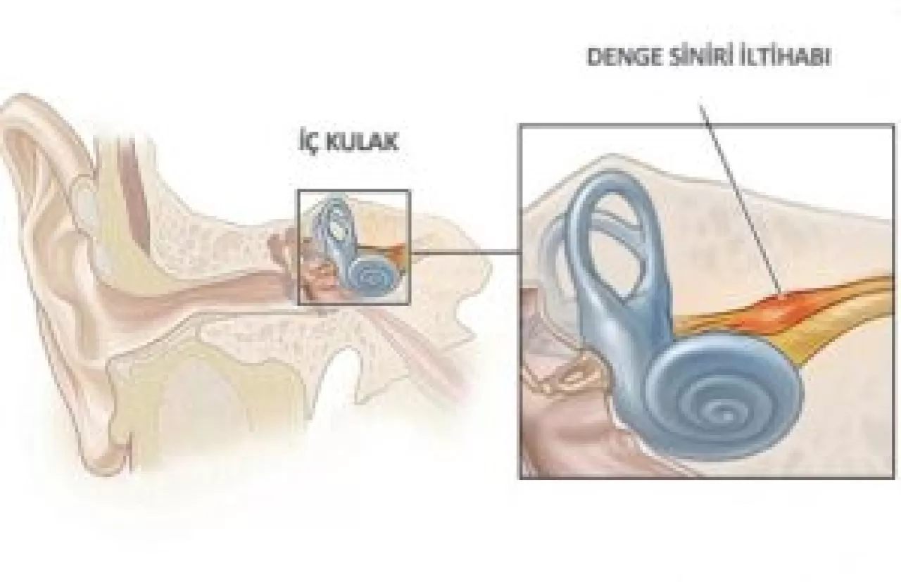 Gizli Denge Sorunu: Baş Dönmesi Olmadan Yaşanan Sersemlik Hissinin Altında Yatan Nedenler