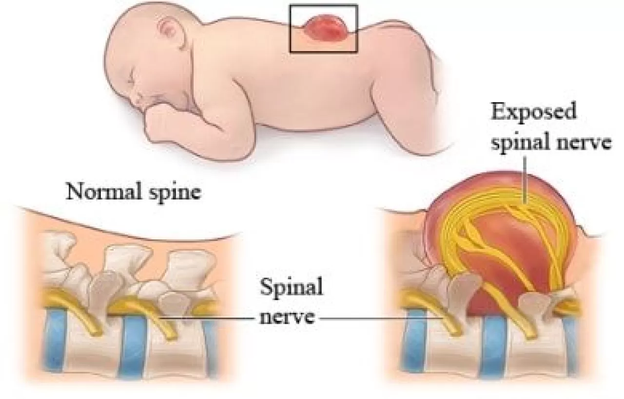Anne ve Bebek Oyunu, Çocuğun Beyin Gelişimini Şekillendiriyor