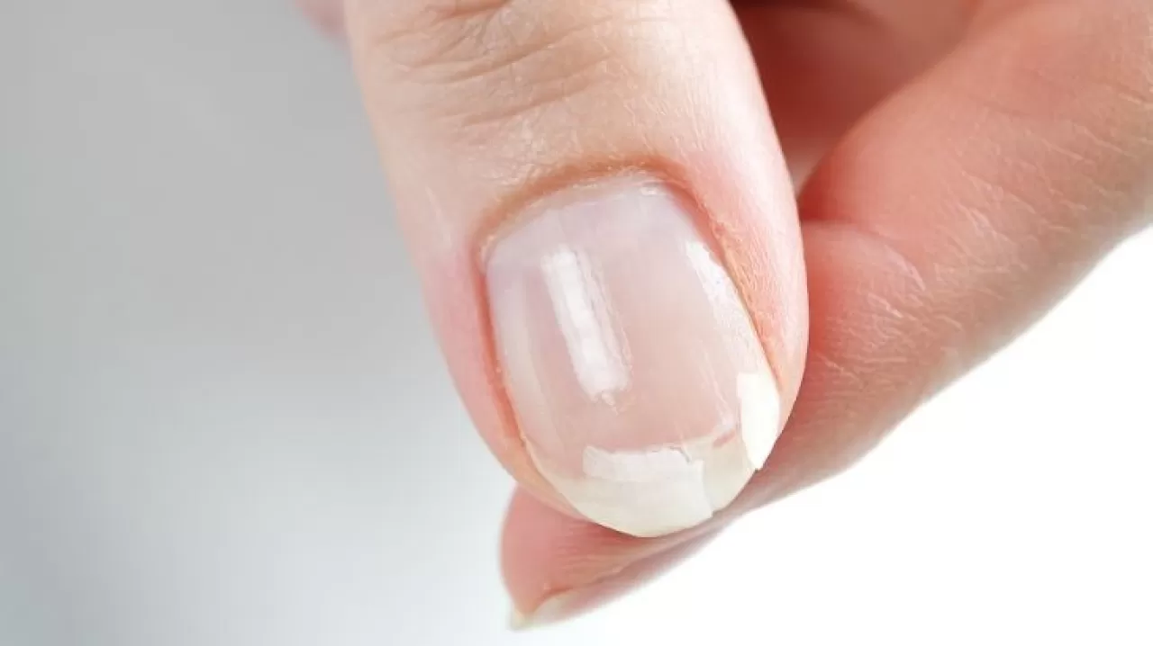Kırılgan Tırnaklar Vücudunuzun Sessiz Çığlığı Olabilir