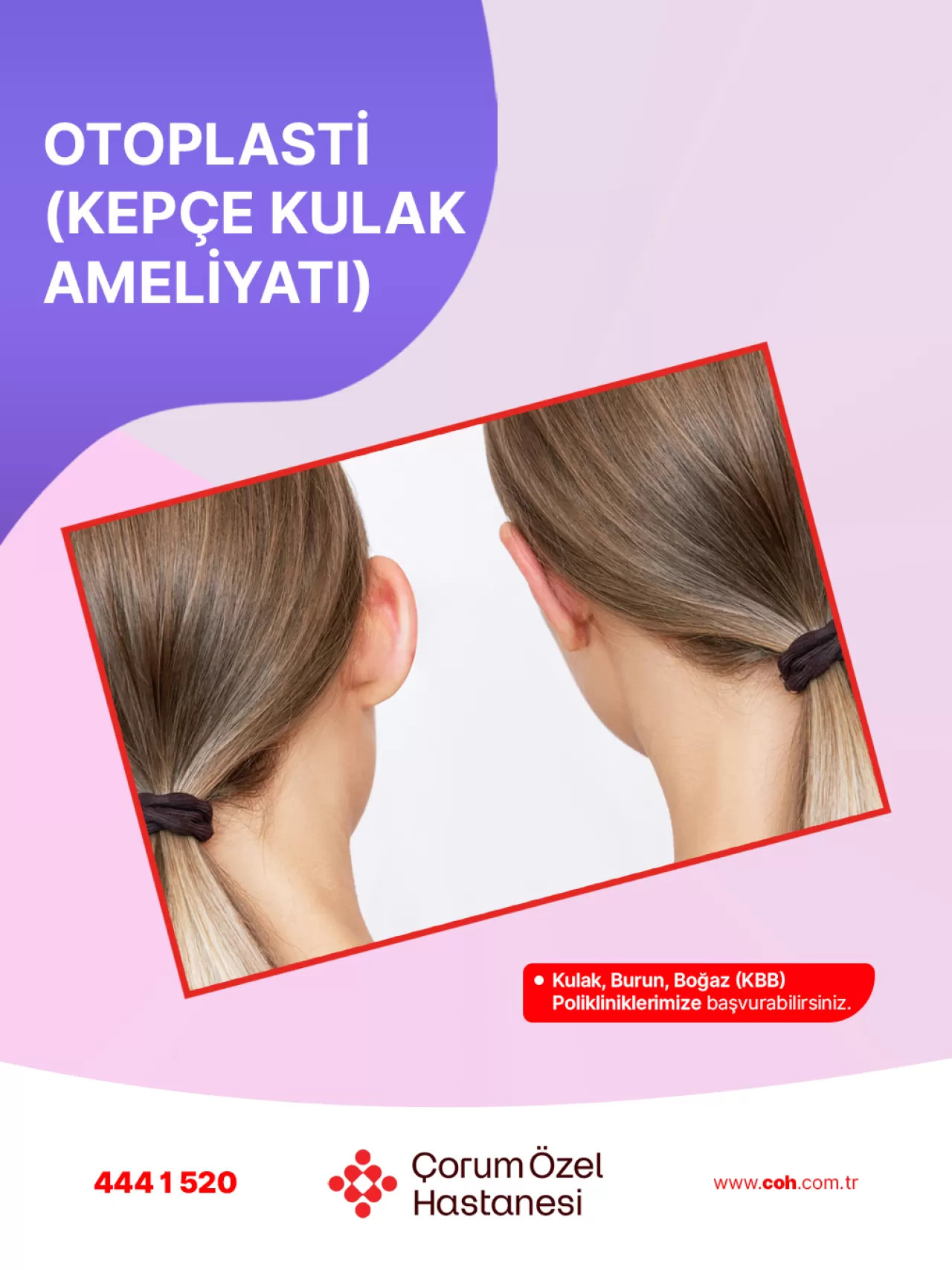 Kepçe Kulak Ameliyatı ile Estetik ve Özgüven Kazanın | Çorum Özel Hastanesi