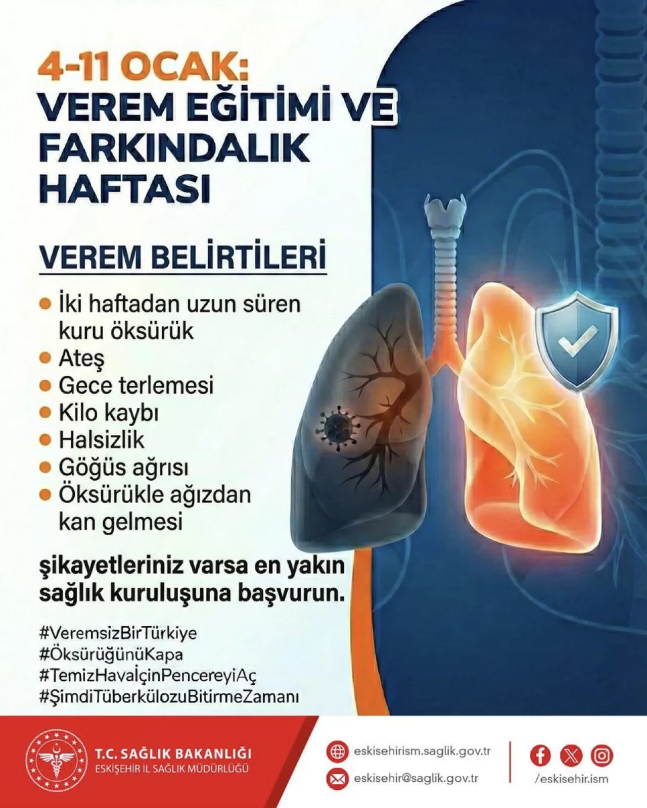 Eskişehir'de Verem Haftası: Belirtiler ve Korunma Yolları