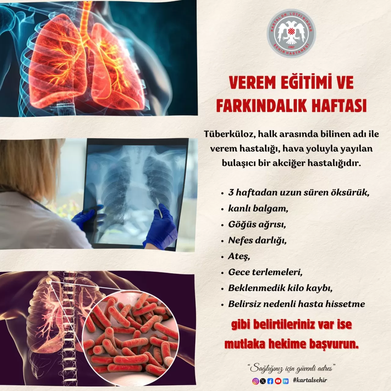 Verem Eğitimi ve Farkındalık Haftası'nda Hastalıkla Mücadele Gündeme Geldi