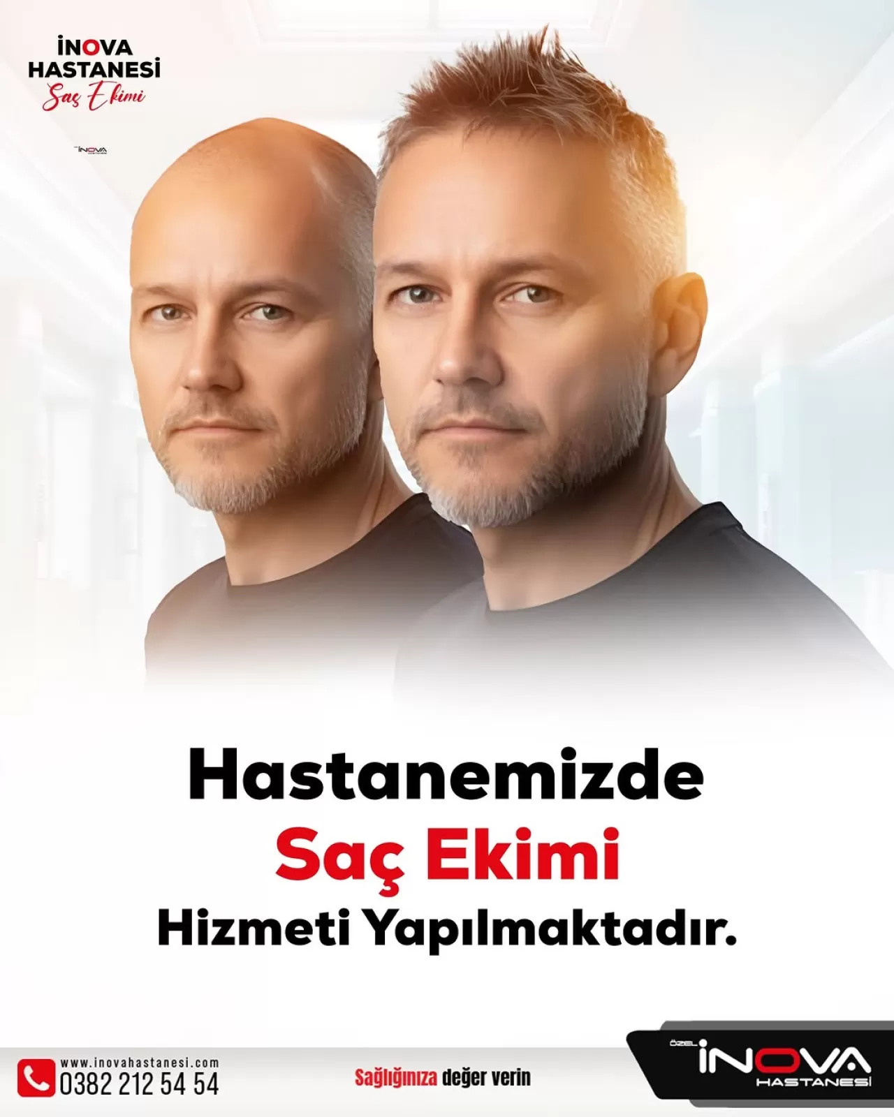 Aksaray İnova Hastanesi'nde Saç Ekiminde Yeni Dönem: FUE Tekniği ve PRP Tedavisi