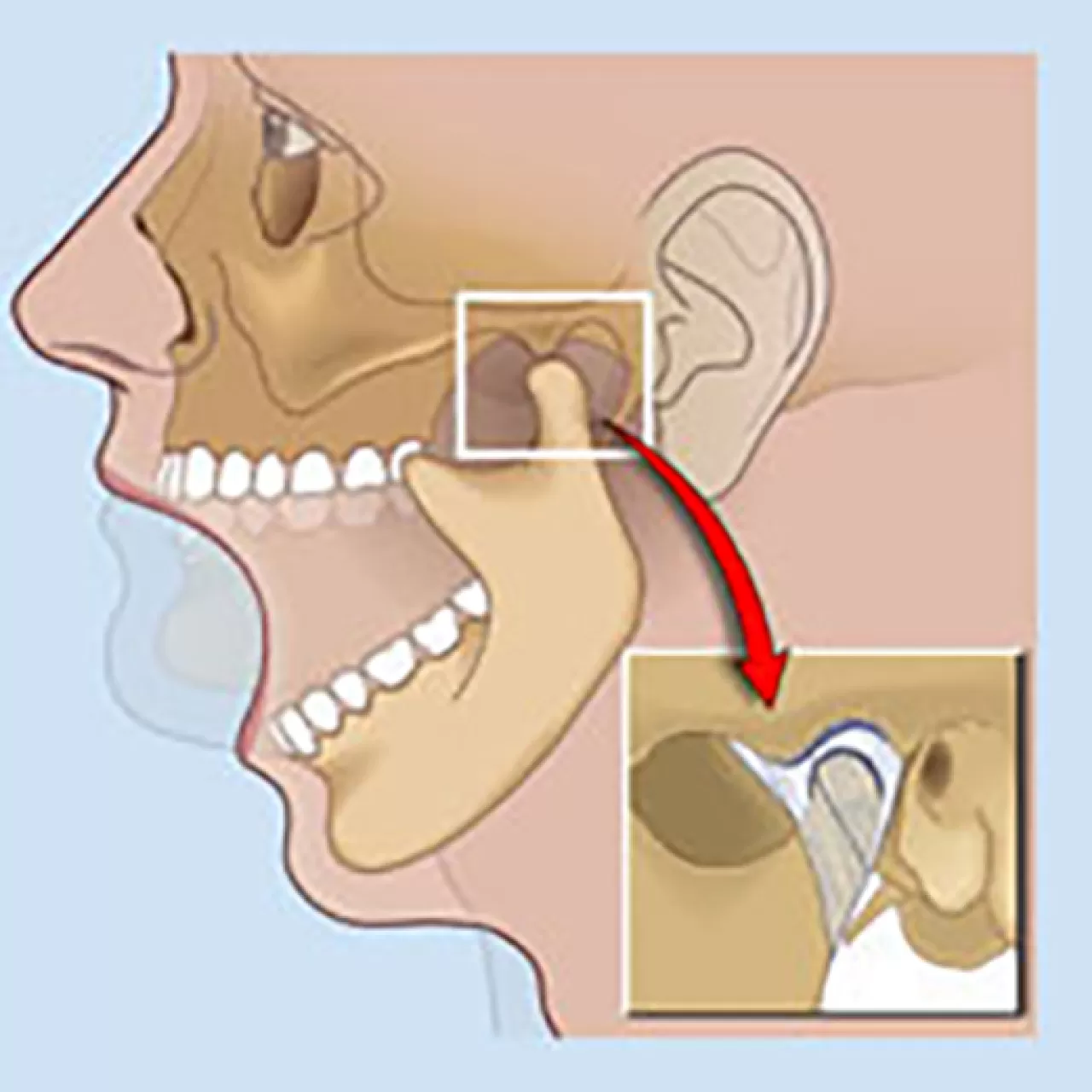 Sessiz Tehlike: Gün İçi Çene Kenetlemesi ve Gözden Kaçan İşaretleri
