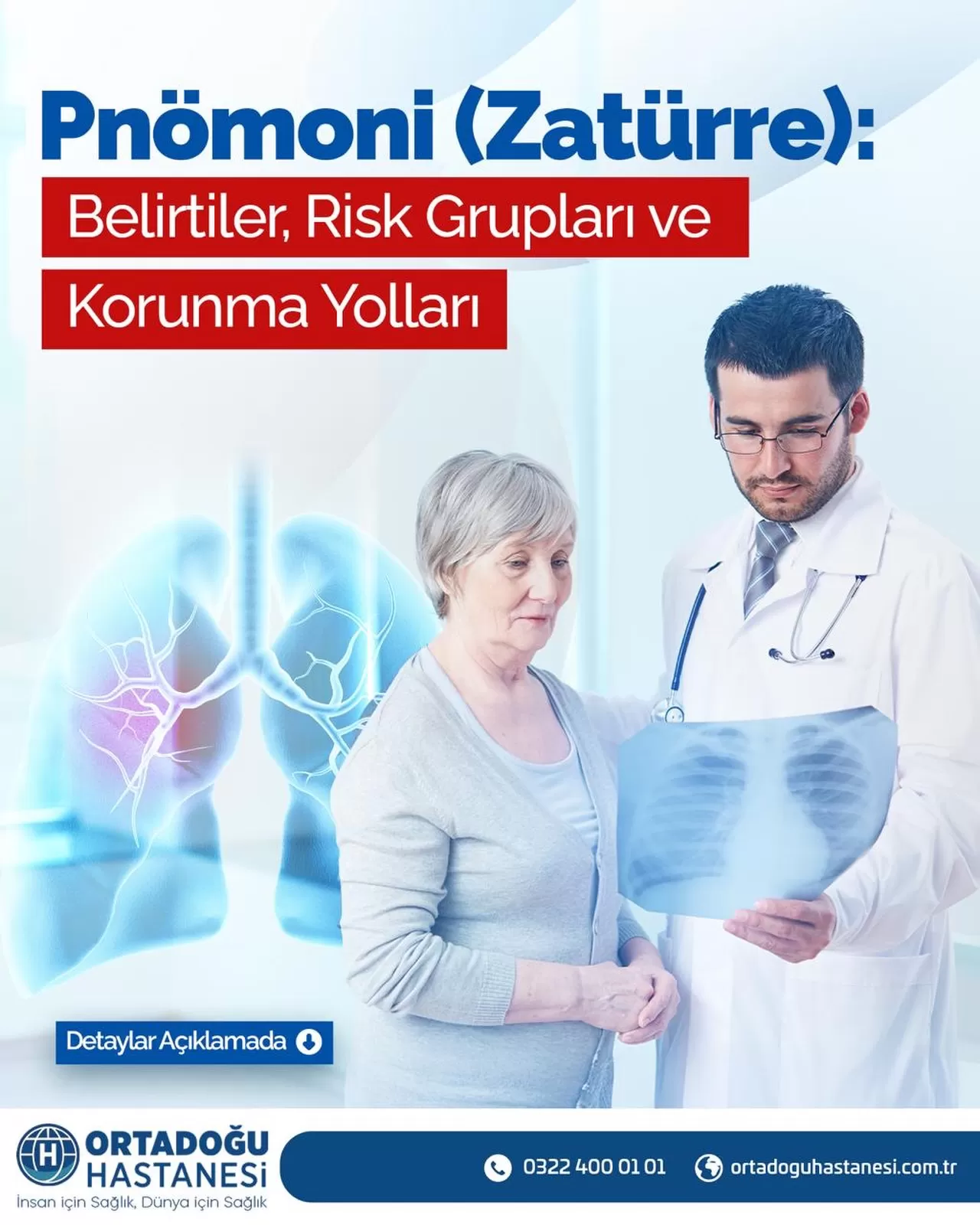 Zatürre (Pnömoni) Belirtileri ve Korunma Yolları Hakkında Önemli Uyarılar