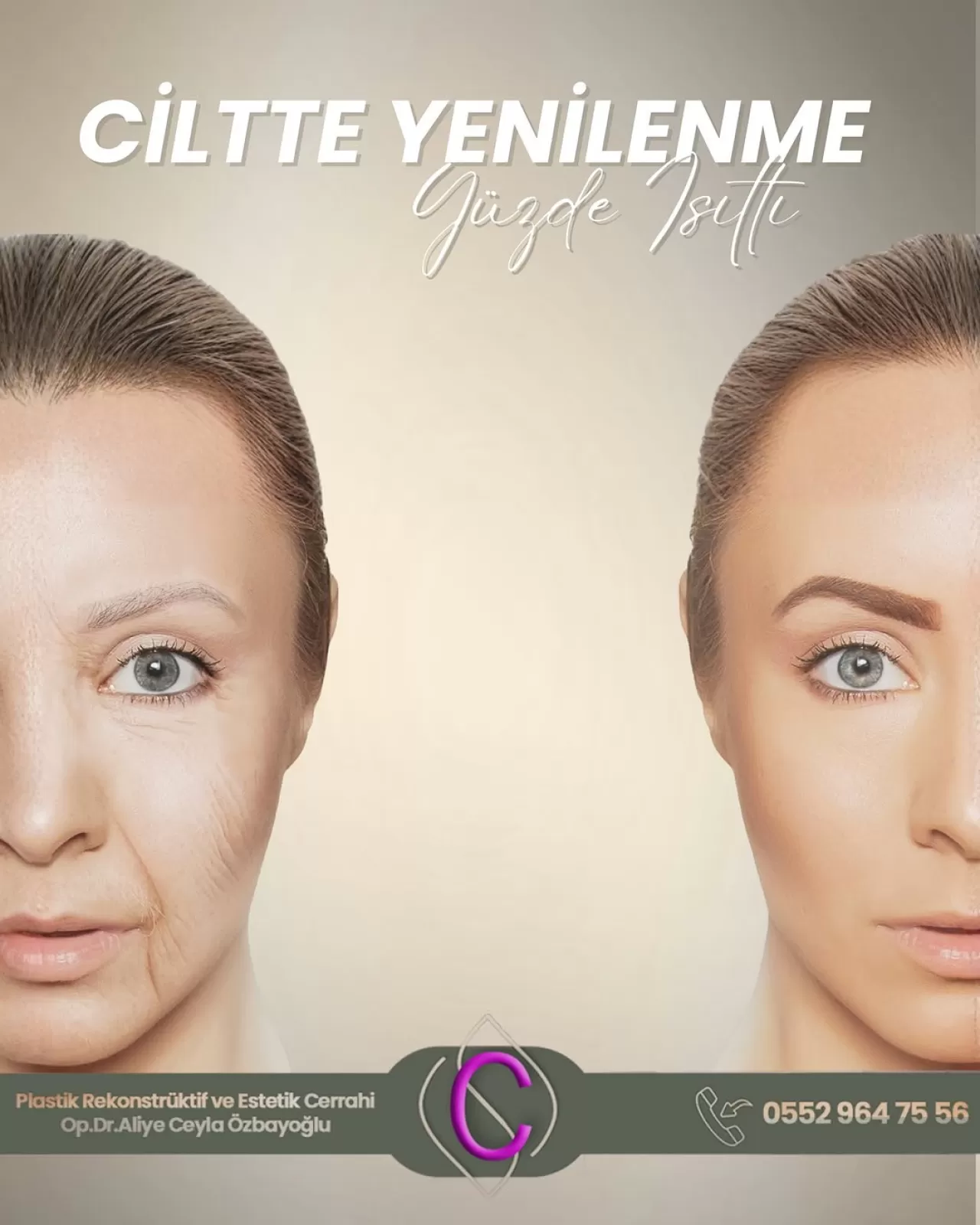 Gençlik Aşısı ile Cildinizi Yenileyin: Zamana Meydan Okuyun