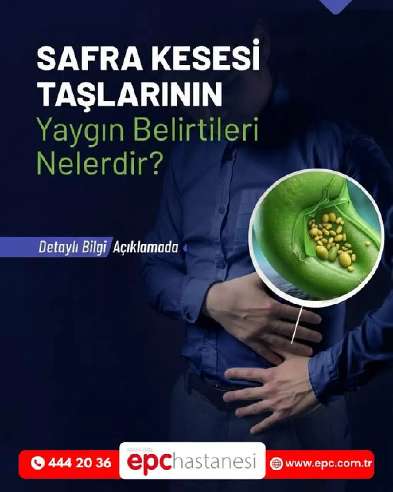 Safra Kesesi Taşları: Sessiz Tehlikenin Belirtileri ve Yönetimi