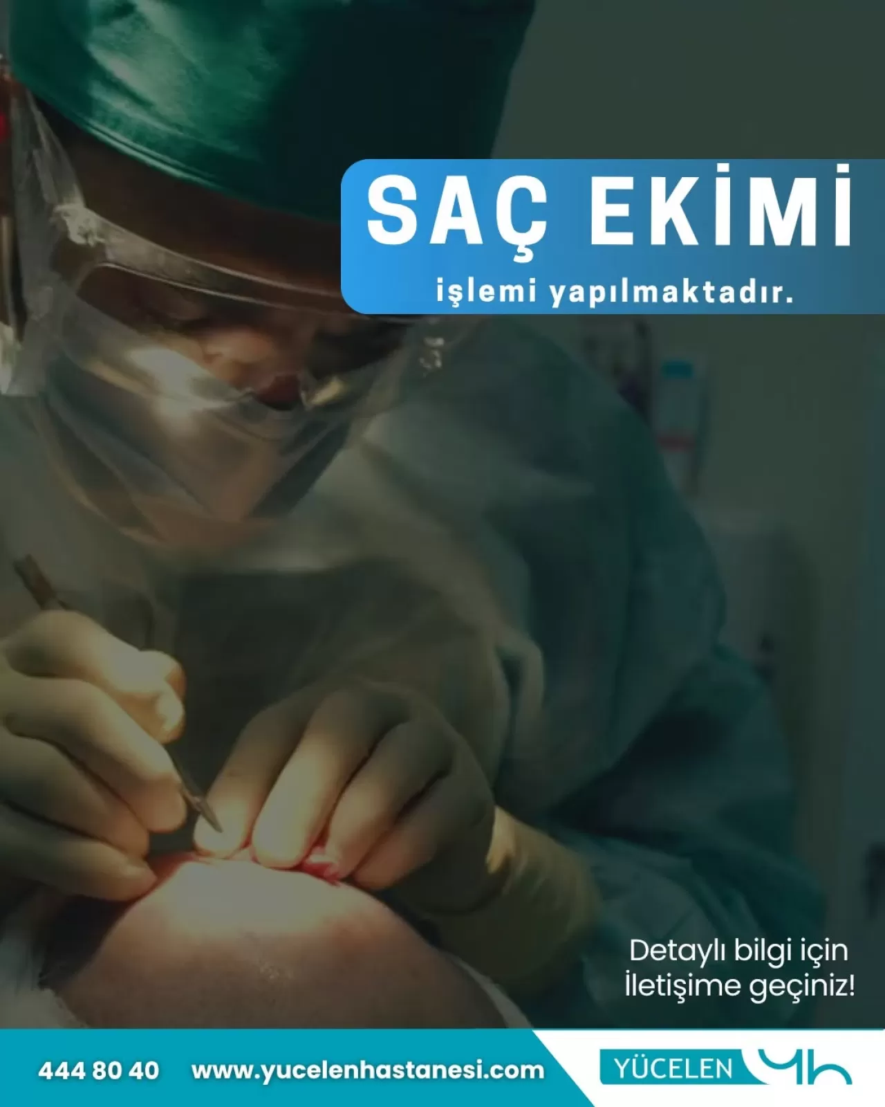 Saç Dökülmesi Tedavisinde Modern Çözüm: Saç Ekimi ile Doğal ve Dolgun Saçlara Kavuşun