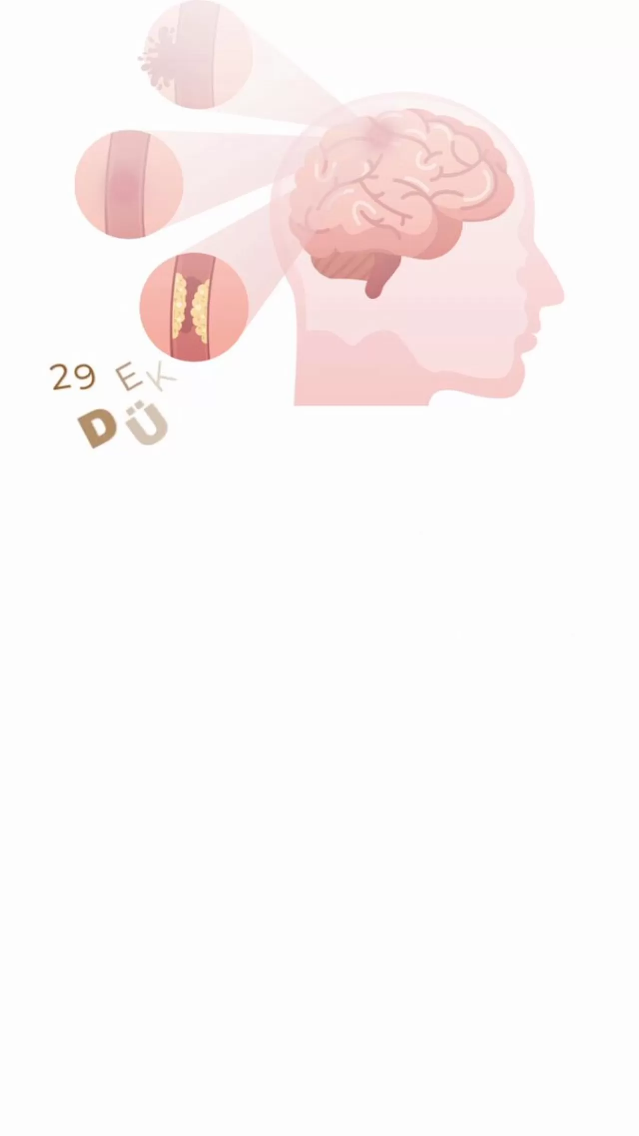 Elazığ'da 29 Ekim Dünya İnme Günü'nde Önemli Uyarılar