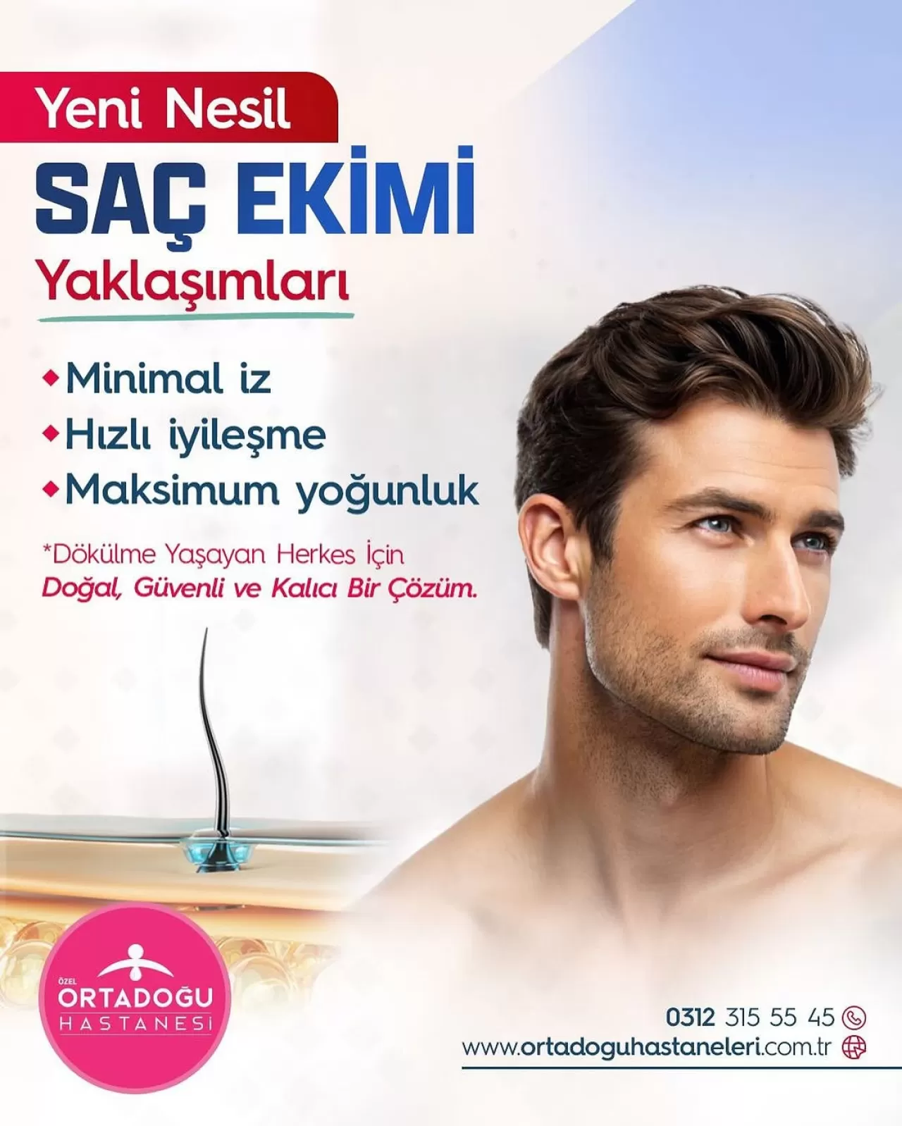 Ankara'da Saç Kaybına Kalıcı Çözüm: Ortadoğu Hastanesi Yeni Nesil Saç Ekimi